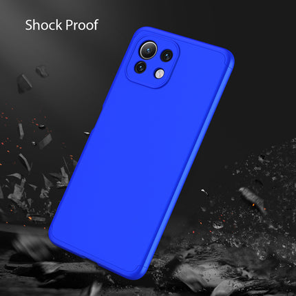 Double Dip Full 360 Protection Back Case Cover for Xiaomi Mi 11 Lite (Blue)