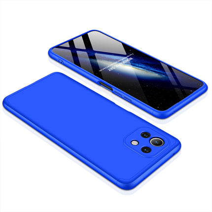 Double Dip Full 360 Protection Back Case Cover for Xiaomi Mi 11 Lite (Blue)